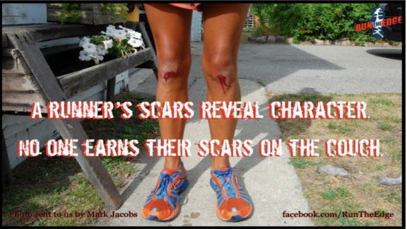 Runner Things #2727: A runner's scars reveal character. No one earns their scars on the couch. - fb,running