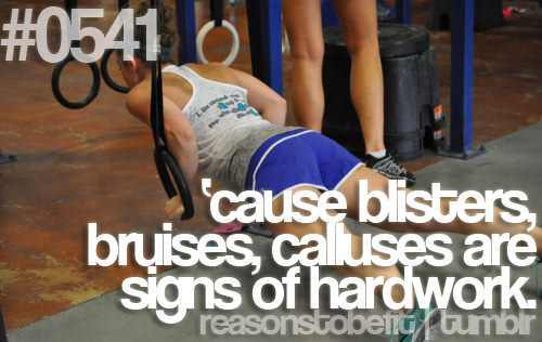 Fitness Stuff #291: Reasons to be fit: Cause blisters, bruises, calusses are signs of hardwork.