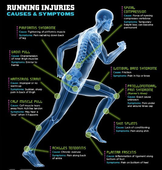 Fitness Stuff #301: Running Injuries